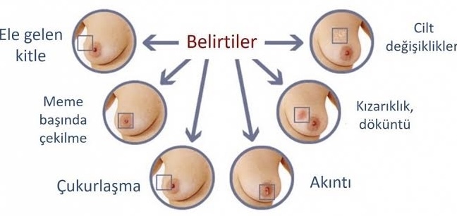 Belirtileri önemseyin ❤️