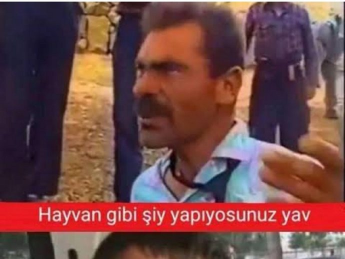 Cinsel ilişkide karşı taraf saçınız aşırı derecede çekse ona nasıl bir tepki verirsiniz?
