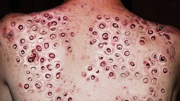 Tripofobiniz var mı?