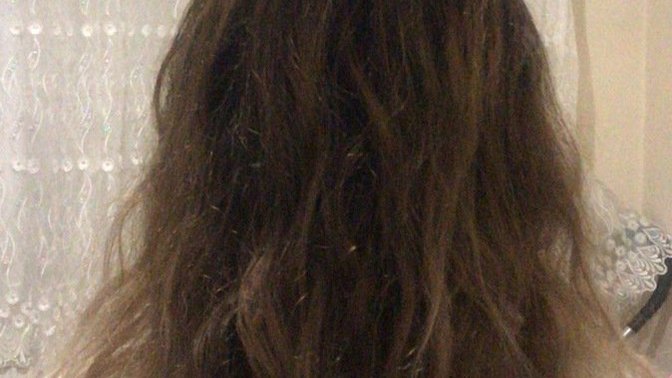 Saçlarım çok kötü yandı sizce ne yapmalıyım, ombre istiyorum ama yanık olduğu için 1000 TL diyen bile var ombre yaptırsam mı? ?