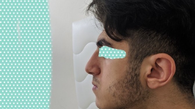 Benim kaş yerindeki kemiğim neden böyle çıkık ya?