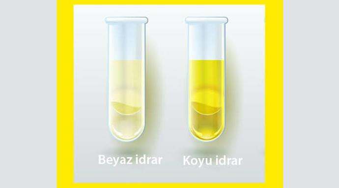 İdrar renginiz koyu sarı mı berrak mı?
