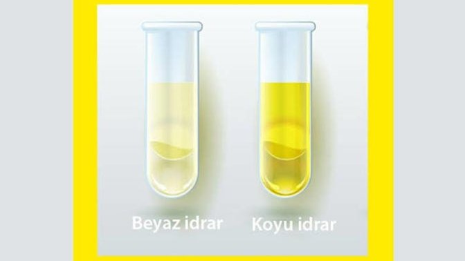İdrar renginiz koyu sarı mı berrak mı?