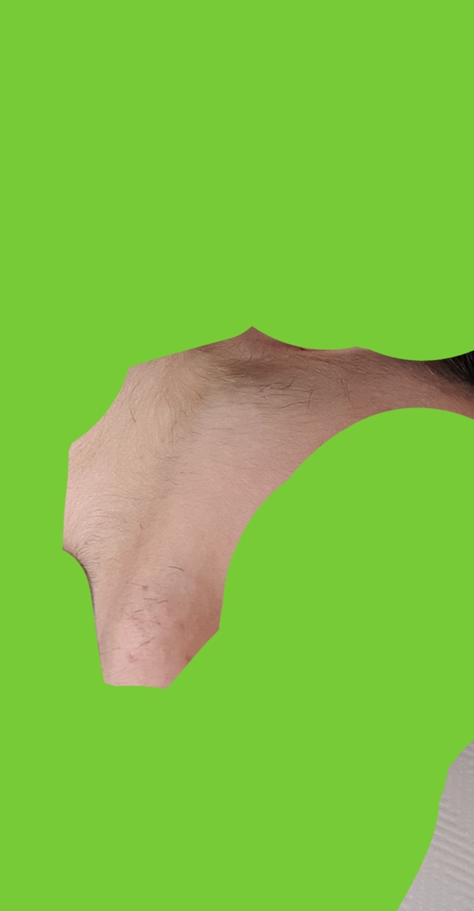 Dayanamiyorum Suratımda ki tüyler erkek gibi? Çok kıllıyım? Fotolu? Yardim?