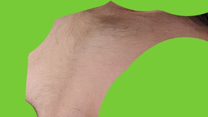 Dayanamiyorum Suratımda ki tüyler erkek gibi? Çok kıllıyım? Foto'lu? Yardim?