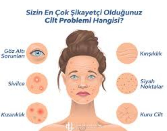 Gözaltı sorunları diyorum kırışıklıga henüz zamanim var 😂😂