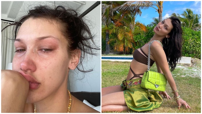 Bella Hadid ağlayarak ne kadar tükendiğini anlattı! Sosyal medya sizce bir yalandan mı ibaret?