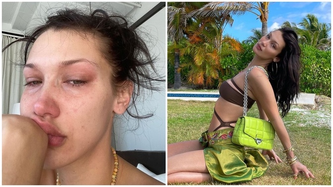 Bella Hadid ağlayarak ne kadar tükendiğini anlattı! Sosyal medya sizce bir yalandan mı ibaret?