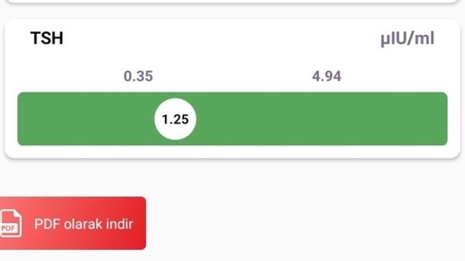 Kan tahlil sonucundan anlayan var mı?