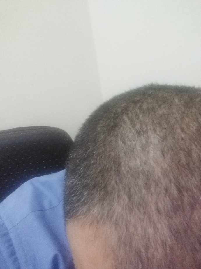 Saçlarınız mı daha çok yıprandı, psikolojiniz mi?