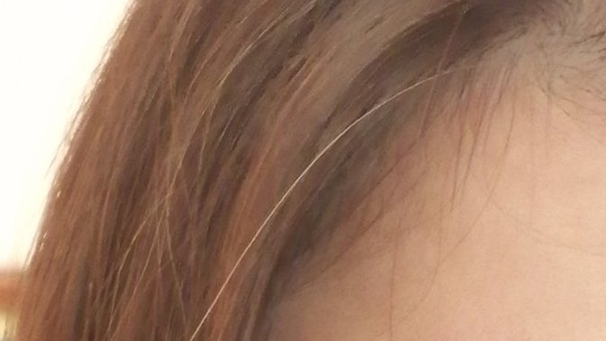 Saçlarım sararıp dökülüyor sararmasının nedeni nedir?