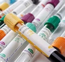 En büyük fobileriniz ile yüzleşmeniz kolay oluyor mu?