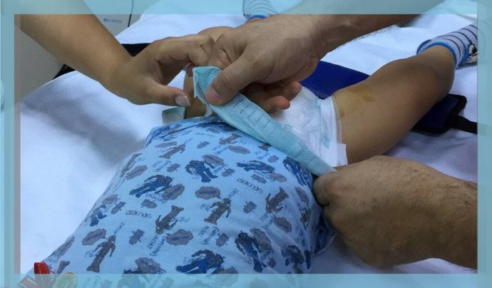 sunnet sargisi nasil acilir?