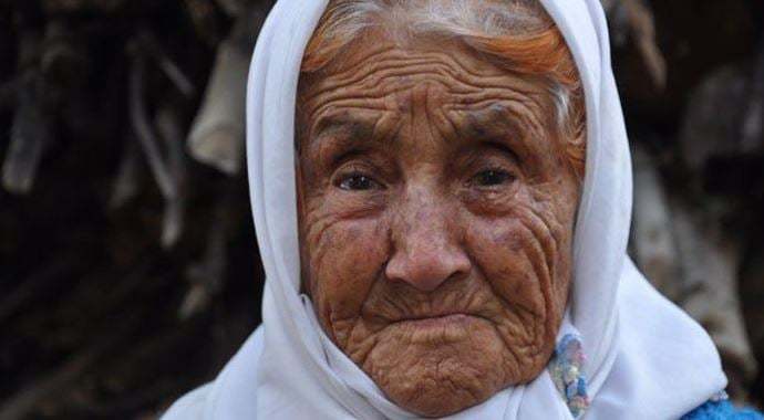 Annenizin 1 gözü kör olsa ondan utanır mısınız?