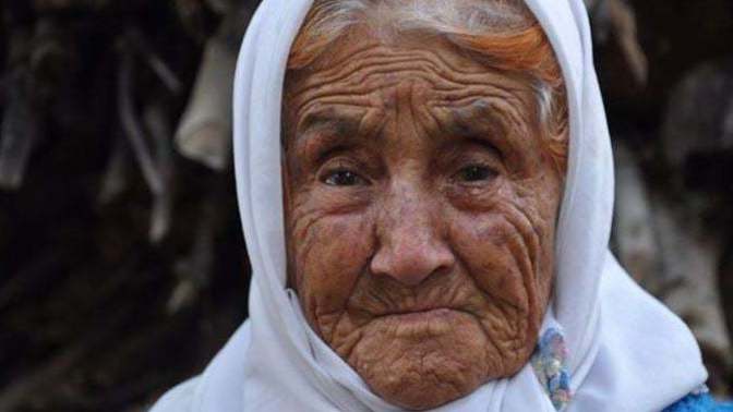 Annenizin 1 gözü kör olsa ondan utanır mısınız?
