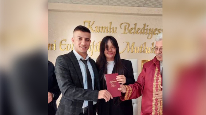 Berfin Özek, yüzüne kezzap atan sevgilisiyle evlendi. Ne düşünüyorsunuz?