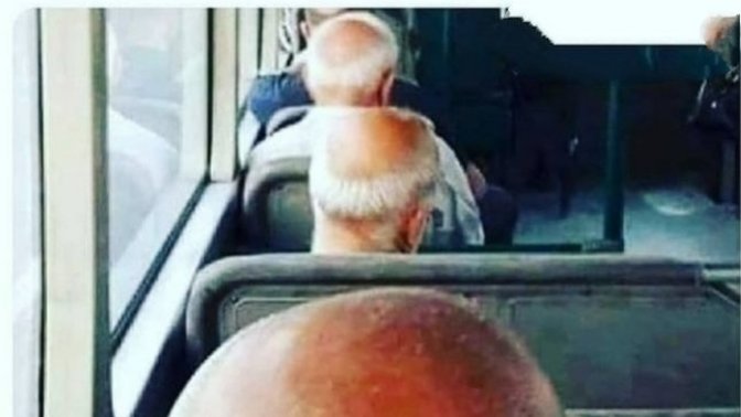 Kel olan insanlar size de çekici geliyor mu🙈?