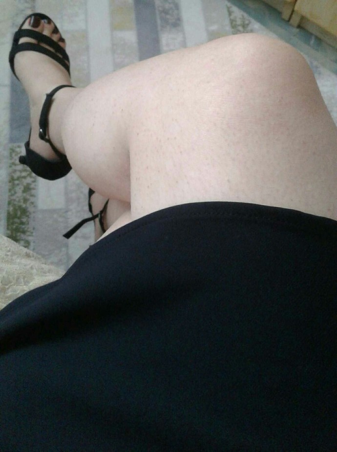 Bacaklarımda sivilce ve kilom var napicam sizce?