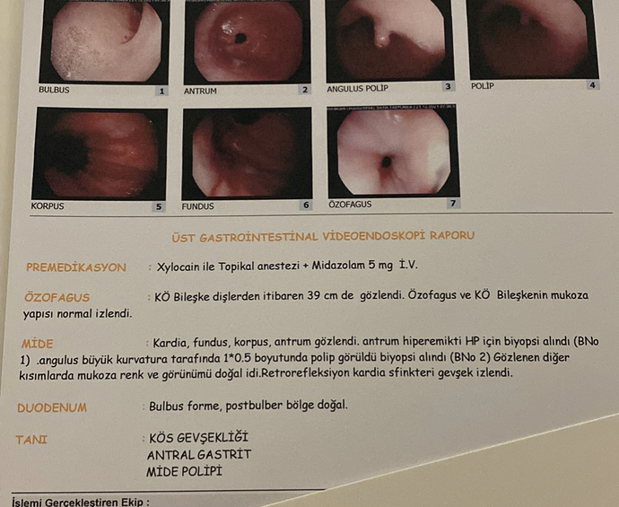 Midede polip korkulacak bir şey mi? KizlarSoruyor