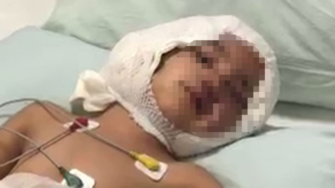 Mahkemenin "Pitbull" kararı vicdanlara az da olsa su serpti! Peki bu karar artık emsal teşkil eder mi?