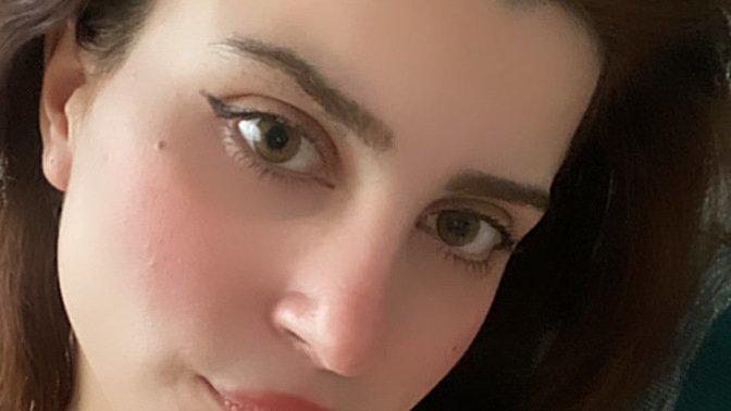 Kızıl saç olur mu?