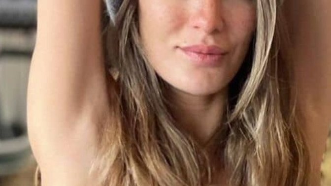 Kızlar, merve oflaz lazer mi yaptırmış?