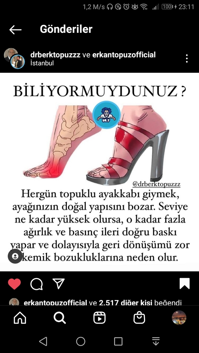 Topuklu ayakkabı giymek sağlığa zararlı mı?