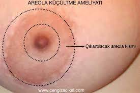 Kadınların meme ucu çevresi neden kararır öyle normal bir kararma değil simsiyah?