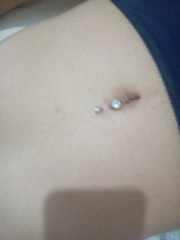 Bi türlü iyileşmeyen göber piercing?