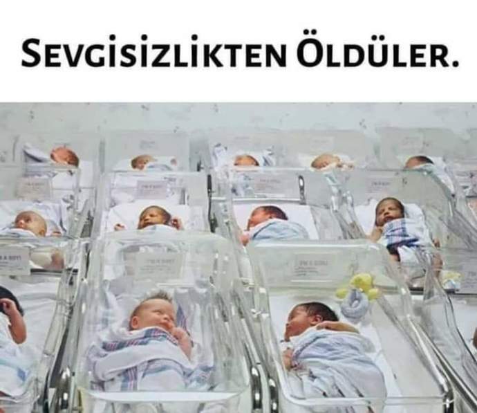 Bebekler yeteri kadar sevgi görmezse sizce ne olur?