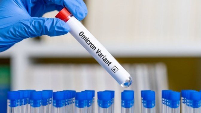 Kovid'in son varyantı omicron dolayısı ile hayatınızda ileriye yönelik olarak neleri ertelediniz?