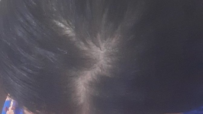 Sizce saçlarım seyrek mi, diplerinin görünmesi normal mi? Eğer seyrekse önereceğiniz bir şey var mı?