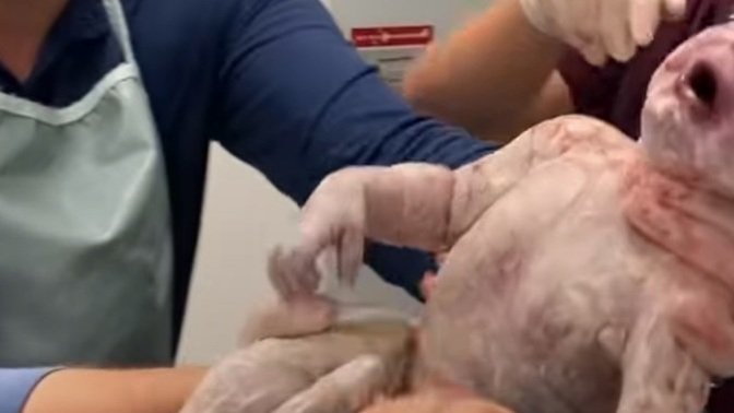 Yeni doğan bebekleri gri renk yapan şey nedir?