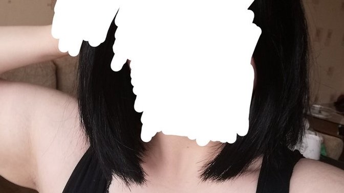 Sarkık kollara kesin çözüm nedir?