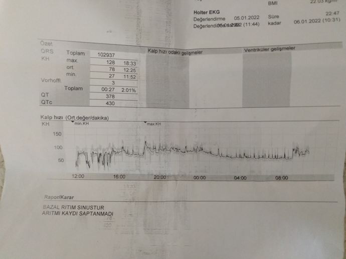 Holter sonuçlarıma bakar mısiniz? ?