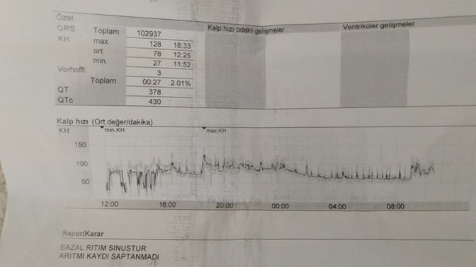 Holter sonuçlarıma bakar mısiniz? ?