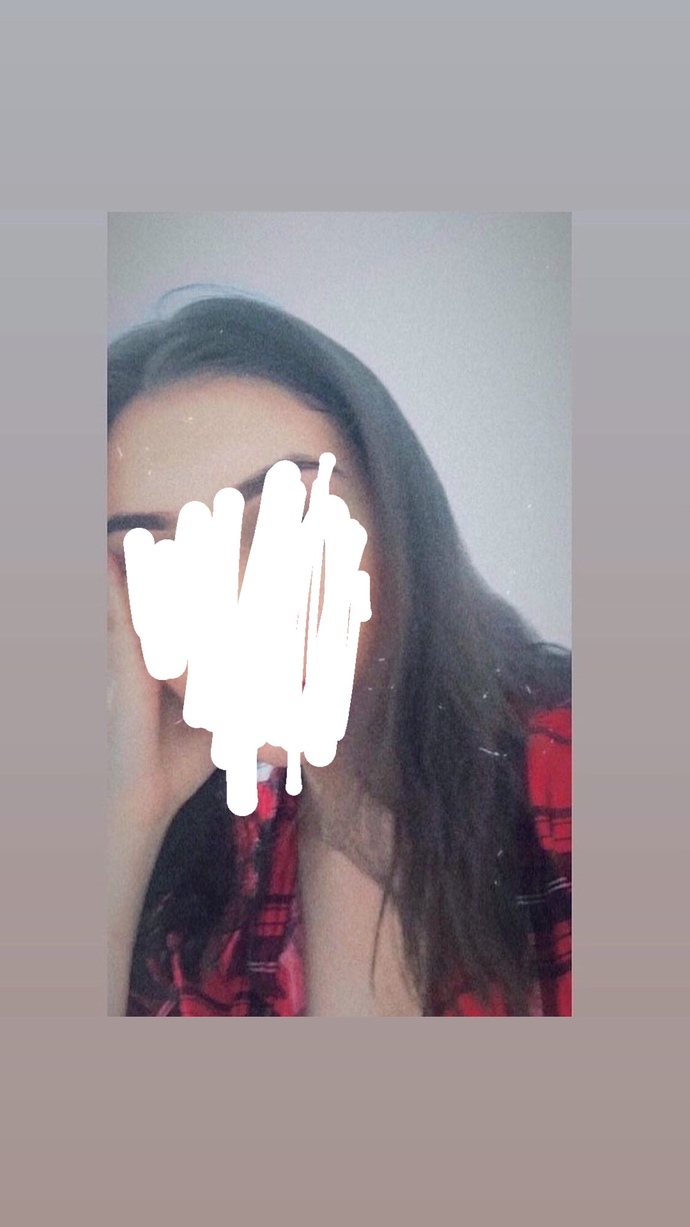 Saçlarım çok döküldü?