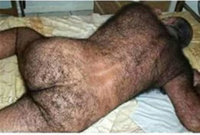 Sırt kılı erkeği çekici yapar mı?