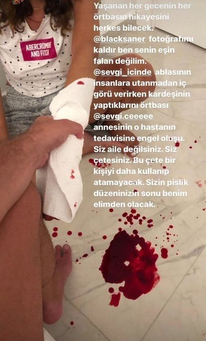 Şiddet uyguladı, selfie çekildi! Berkay Saner gibilerin sonu ne zaman gelecek?