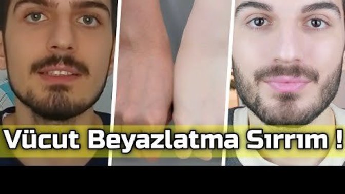 Patates suyu kararmaları ve cilt rengini açıyor mu cidden?