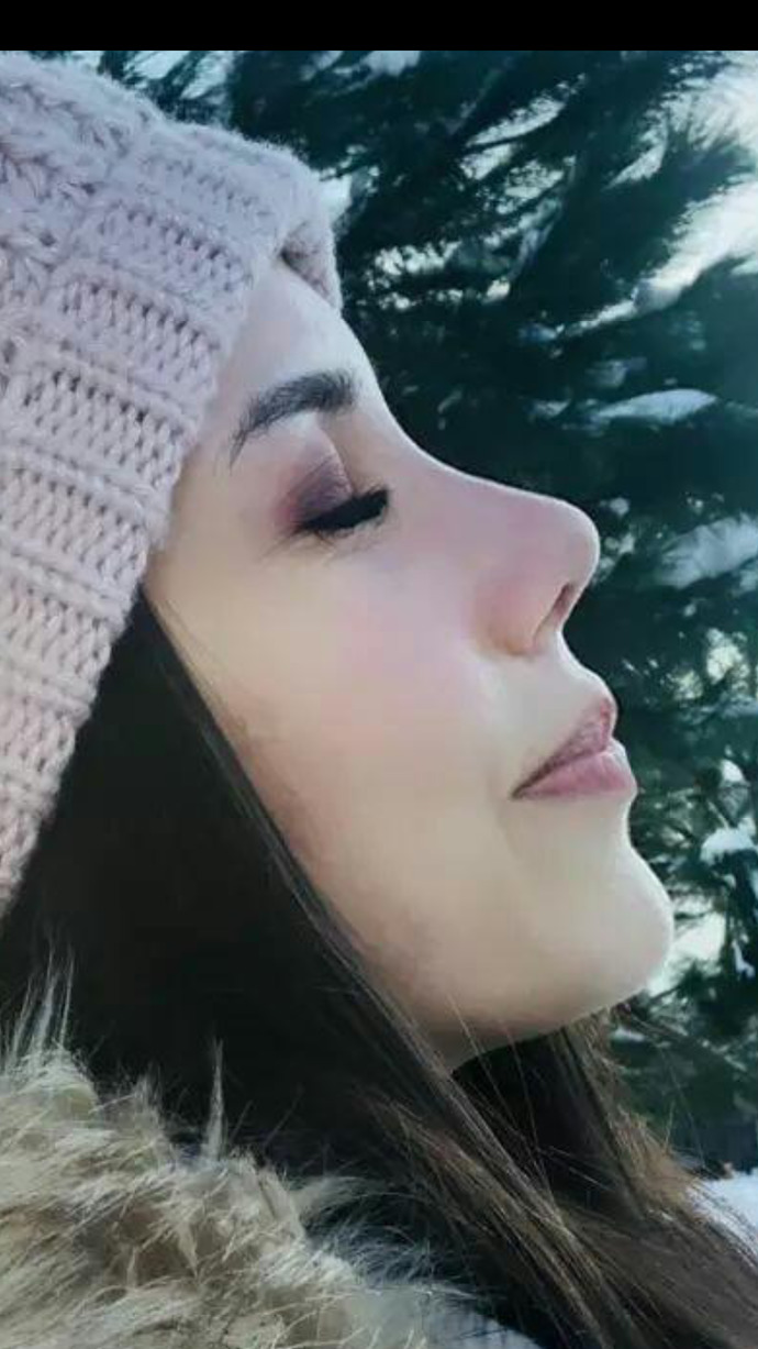 Estetik oldum ama hala burnumu beğenmiyorum. Sizce nasıl?