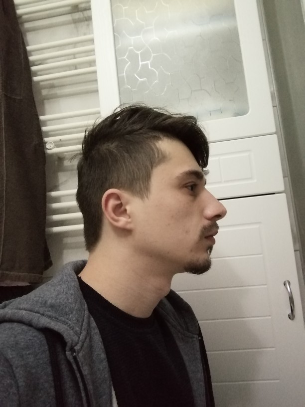 Estetik yaptırmalı mıyım?