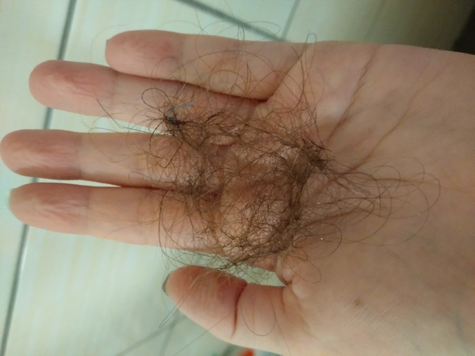 Saç dökülmem normal mi, sizinki ne kadar dökülüyor?