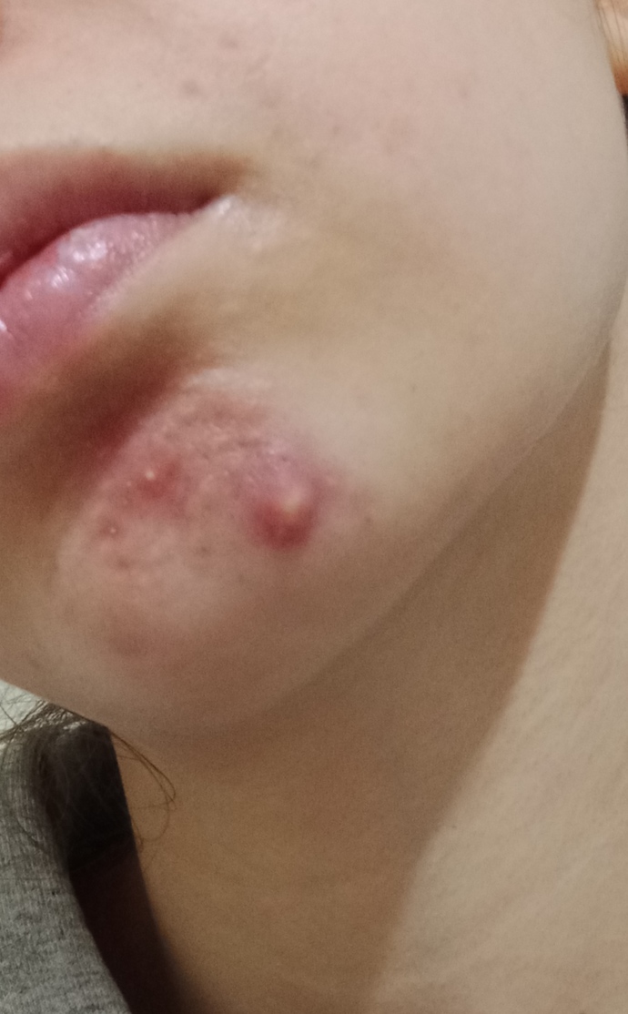 Yarina nasıl geçer okulda böyle dolaşmak istemiyorum?