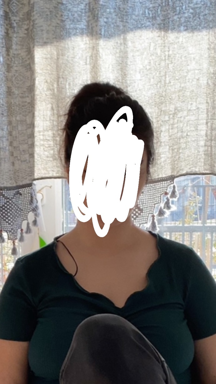 Omuzum ve kollarım niye böyle?