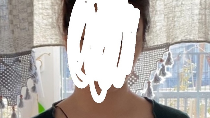 Omuzum ve kollarım niye böyle?