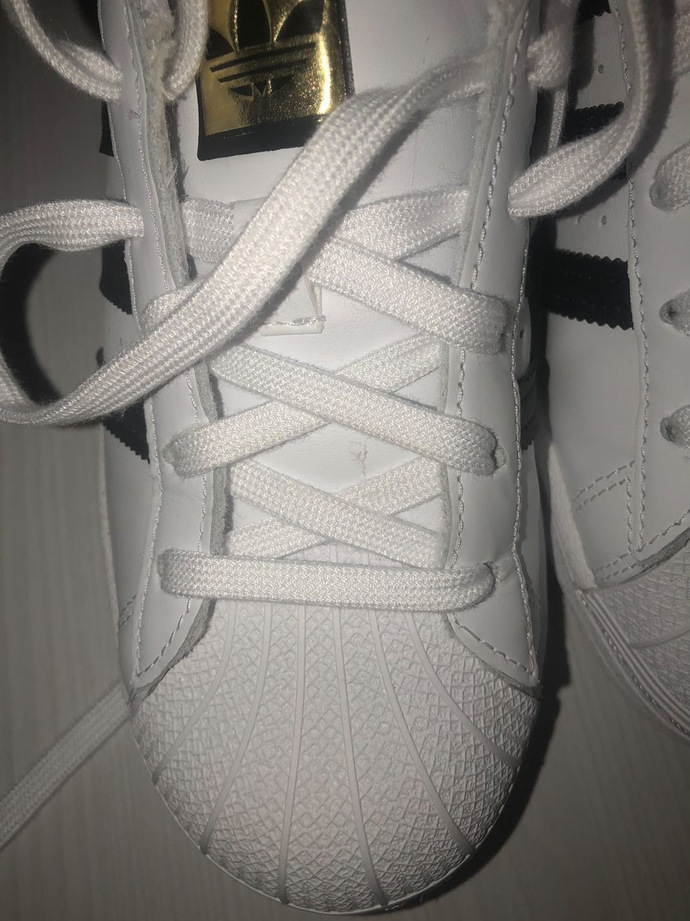 Adidas sitesinde lekeli ayakkabı?