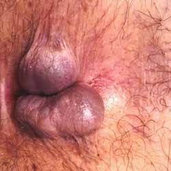 Kadınlarda dolgun dudak çekici mi?