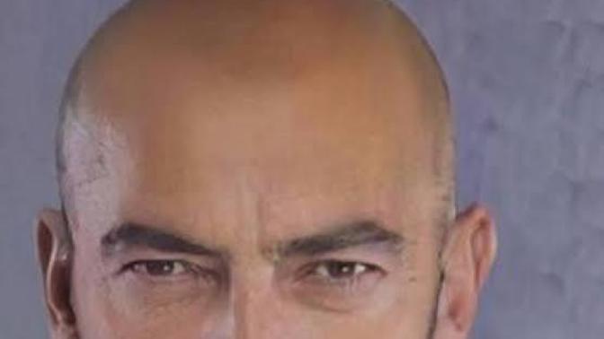 Kel erkekler ilginizi çekiyor mu?