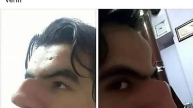 Burnunuzu beğeniyor musunuz (10 üzerinden kaç verirsiniz)?